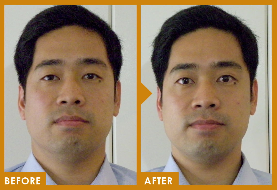 ケース写真[眼精疲労回復]